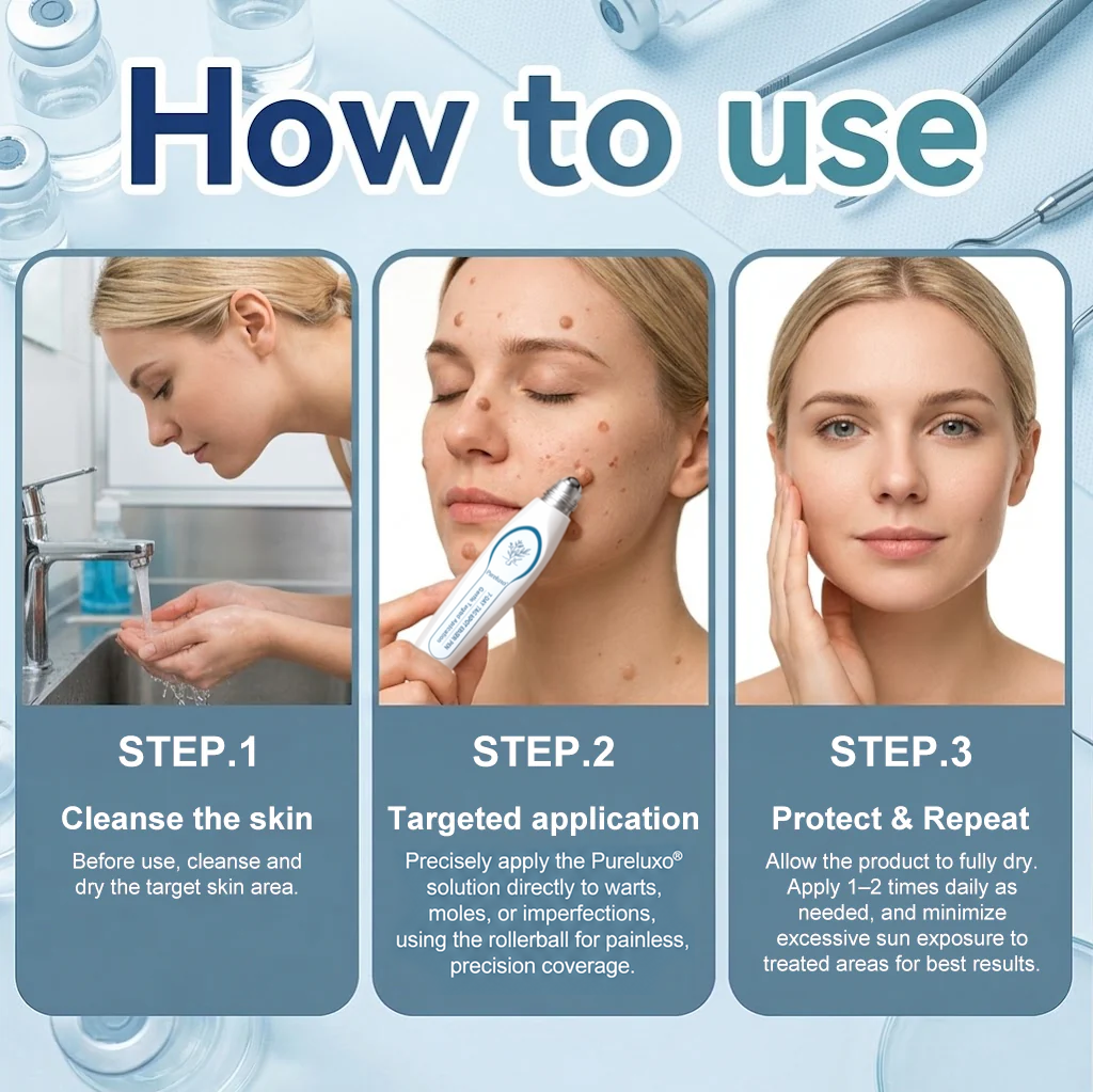 Pureluxo® Skin Tag Remover Roller🌟🏆