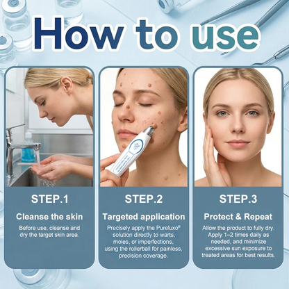 Pureluxo® Skin Tag Remover Roller🌟🏆