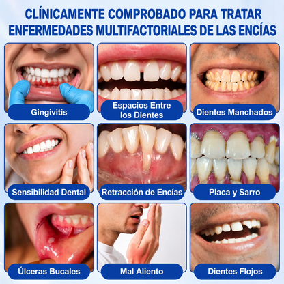 Pureluxo® 🦷Gel reparador periodontal GumRevive🔥
