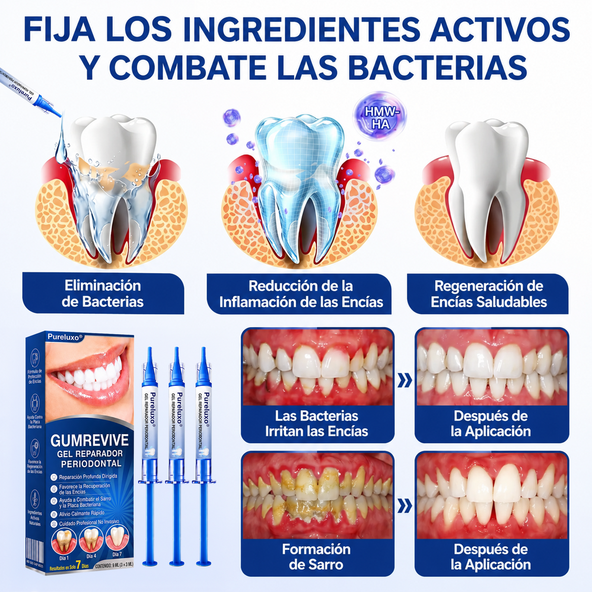 Pureluxo® 🦷Gel reparador periodontal GumRevive🔥