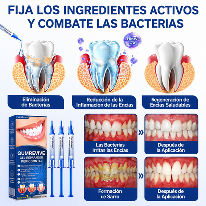 Pureluxo® 🦷Gel reparador periodontal GumRevive🔥