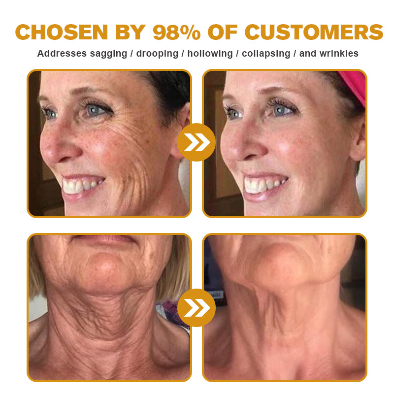 (Made and Shipped from USA) 🧑‍⚕️Pureluxo® Botox Bee Venom Wrinkle Removal Cream- LAST DAY 70% OFF🧑‍⚕️