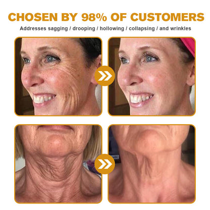 (Made and Shipped from USA) 🧑‍⚕️Pureluxo® Botox Bee Venom Wrinkle Removal Cream- LAST DAY 70% OFF🧑‍⚕️