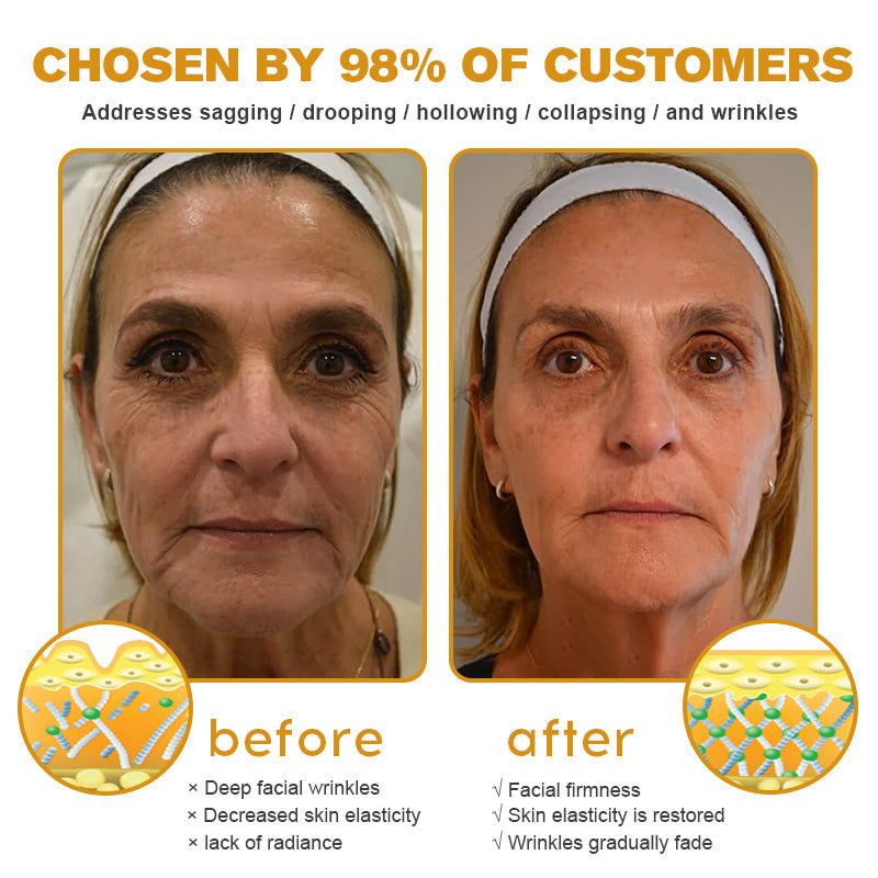(Made and Shipped from USA) 🧑‍⚕️Pureluxo® Botox Bee Venom Wrinkle Removal Cream- LAST DAY 70% OFF🧑‍⚕️