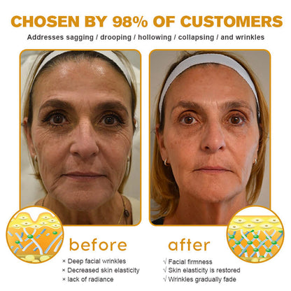 (Made and Shipped from USA) 🧑‍⚕️Pureluxo® Botox Bee Venom Wrinkle Removal Cream- LAST DAY 70% OFF🧑‍⚕️